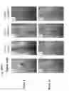 Fig. 06 - Method for regenerating cartilage comprising applying a monovalent metal salt of alginic acid and SDF-1