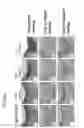 Fig. 07 - Method for regenerating cartilage comprising applying a monovalent metal salt of alginic acid and SDF-1