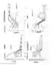 Fig. 05 - Compositions and methods for the systemic treatment of arthritis