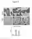 Fig. 04 - Mutant bacteria for production of generalized modules for membrane antigens