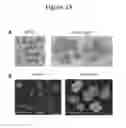 Fig. 10 - Mutant bacteria for production of generalized modules for membrane antigens