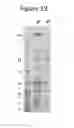 Fig. 15 - Mutant bacteria for production of generalized modules for membrane antigens