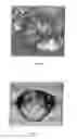 Fig. 06 - Method for carrying therapeutic substances into cells