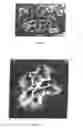 Fig. 07 - Method for carrying therapeutic substances into cells