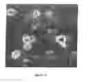 Fig. 08 - Method for carrying therapeutic substances into cells