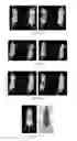 Fig. 07 - PSMA binding ligand-linker conjugates and methods for using