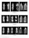 Fig. 08 - PSMA binding ligand-linker conjugates and methods for using