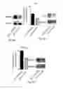 Fig. 08 - Method of preventing and treating type 1 diabetes, allograft rejection and lung fibrosis (by targeting the ATP/P2X7R axis)