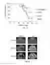 Fig. 09 - Method of preventing and treating type 1 diabetes, allograft rejection and lung fibrosis (by targeting the ATP/P2X7R axis)