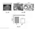 Fig. 10 - Method of preventing and treating type 1 diabetes, allograft rejection and lung fibrosis (by targeting the ATP/P2X7R axis)