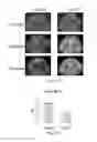 Fig. 15 - Method of preventing and treating type 1 diabetes, allograft rejection and lung fibrosis (by targeting the ATP/P2X7R axis)