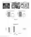 Fig. 16 - Method of preventing and treating type 1 diabetes, allograft rejection and lung fibrosis (by targeting the ATP/P2X7R axis)