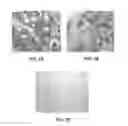 Fig. 03 - TUMOR SPECIFIC ANITBODY CONJUGATES AND USES THEREFOR