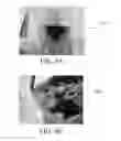 Fig. 08 - FIBRINOGEN-BASED TISSUE ADHESIVE PATCHES