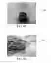 Fig. 09 - FIBRINOGEN-BASED TISSUE ADHESIVE PATCHES