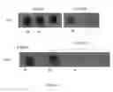 Fig. 05 - Bone substitute nanocomposites and methods of synthesis using multiphosphorylated peptides