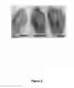 Fig. 05 - Decellularization and recellularization of whole organs