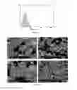 Fig. 08 - Osteoinductive calcium phosphates