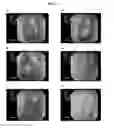 Fig. 02 - Agent for regenerating tympanic membrane or external auditory canal
