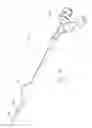 Fig. 12 - TRANSCUTANEOUS DEVICE FOR REMOVAL OF FLUID FROM A BODY