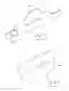 Fig. 15 - TRANSCUTANEOUS DEVICE FOR REMOVAL OF FLUID FROM A BODY