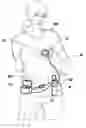 Fig. 01 - SYSTEM AND METHOD OF USE FOR A CONCEALABLE AND REDUCED NOISE BREAST PUMP