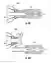 Fig. 32 - Devices, systems, and methods for implanting and using a connector in a tissue wall