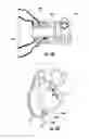 Fig. 33 - Devices, systems, and methods for implanting and using a connector in a tissue wall