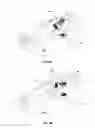 Fig. 06 - Transcutaneous power transmission utilizing non-planar resonators