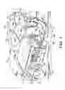 Fig. 02 - Drain and fill logic for automated peritoneal dialysis