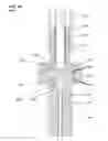Fig. 17 - Filtering needle cap having a sleeve sealing around a needle
