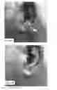 Fig. 12 - DEVICES AND METHODS FOR TREATING TISSUES AND TISSUE CONDITIONS