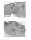Fig. 13 - DEVICES AND METHODS FOR TREATING TISSUES AND TISSUE CONDITIONS