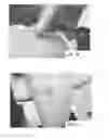Fig. 14 - DEVICES AND METHODS FOR TREATING TISSUES AND TISSUE CONDITIONS
