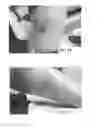 Fig. 15 - DEVICES AND METHODS FOR TREATING TISSUES AND TISSUE CONDITIONS