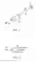Fig. 12 - Carboxy therapy applicator