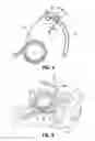 Fig. 06 - Endopharyngeal airway device and kit and method of use