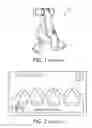Fig. 02 - Method and device for sizing masks