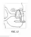 Fig. 08 - Method and device for sizing masks