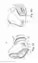 Fig. 02 - Infant nasal interface mask