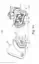 Fig. 05 - Infant nasal interface mask
