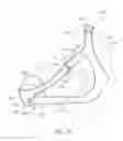 Fig. 16 - Headgear for breathing mask