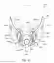 Fig. 33 - Headgear for breathing mask