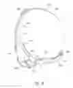 Fig. 54 - Headgear for breathing mask