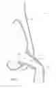 Fig. 04 - Flexible mask coupling