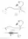 Fig. 02 - A Catheter Having an Expansile Sheath