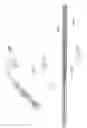 Fig. 35 - A Catheter Having an Expansile Sheath