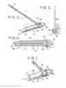 Fig. 03 - Compact catheter assembly with adjustable catheter tube
