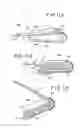 Fig. 06 - Compact catheter assembly with adjustable catheter tube