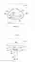 Fig. 11 - Systems and methods for implanting a medical device